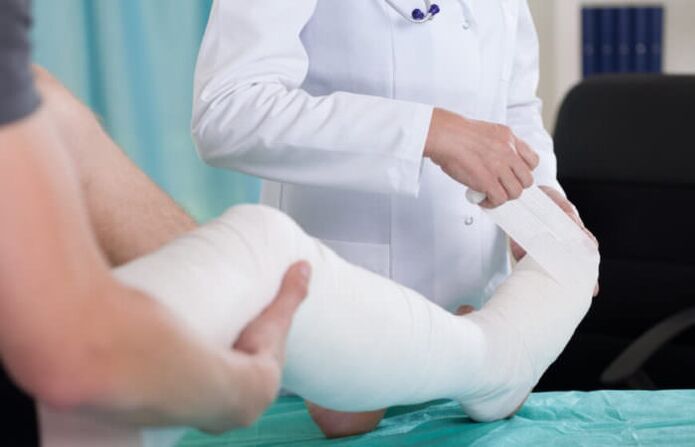 plaster cast for knee pain