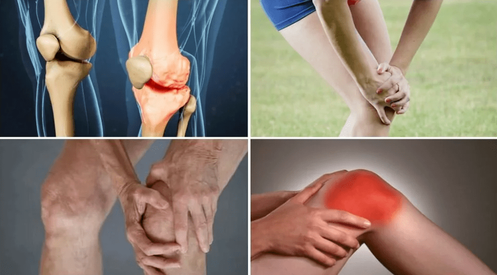 Symptoms of arthrosis
